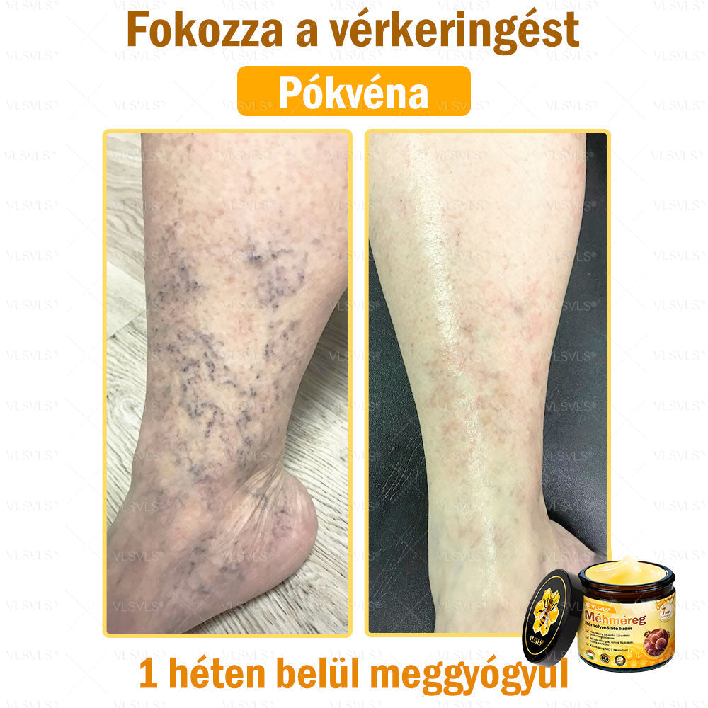 VLSVLS® Méhméreg Bőrhelyreállító Krém (👨⚕CE jóváhagyott)👍✅