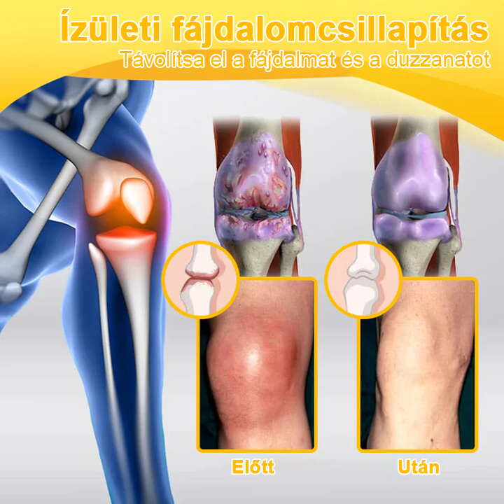 🦴TLOPA® Botulinum Toxin és Méhméreg Fájdalomcsillapító Csontgyógyító Krém🐝 🔥(Kifejezetten időseknek & ortopéd szakorvosok ajánlásával)🦴🦴🦴🦴🦴
