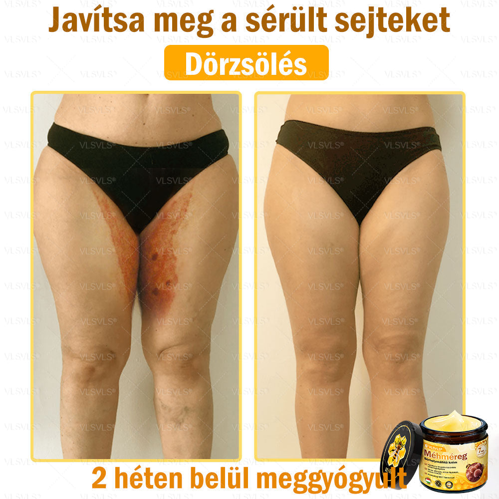 VLSVLS® Méhméreg Bőrhelyreállító Krém (👨⚕CE jóváhagyott)👍✅