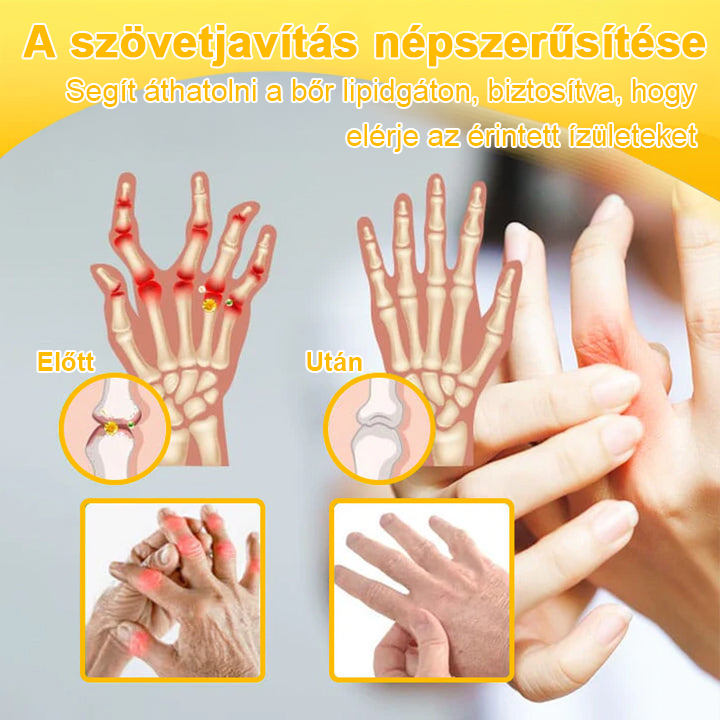 🦴TLOPA® Botulinum Toxin és Méhméreg Fájdalomcsillapító Csontgyógyító Krém🐝 🔥(Kifejezetten időseknek & ortopéd szakorvosok ajánlásával)🦴🦴🦴🦴🦴