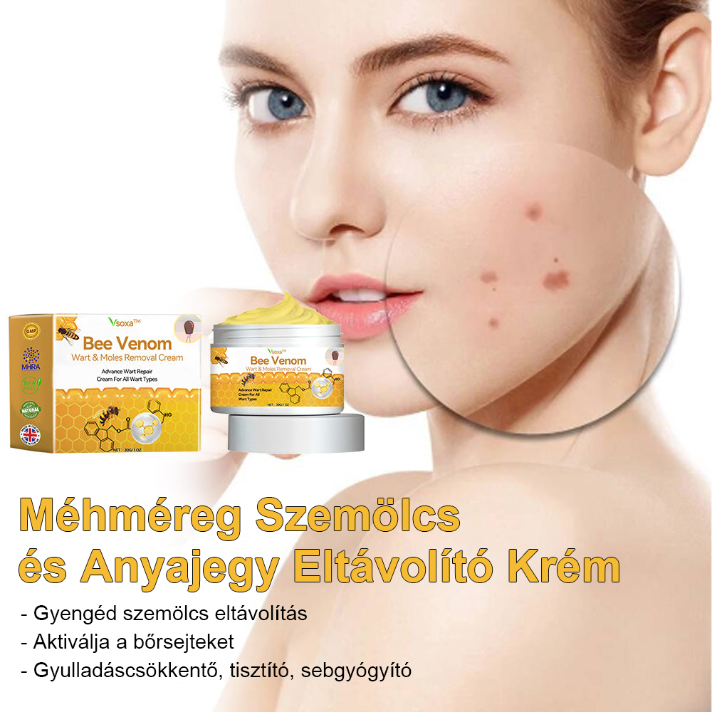 đ”ïžVsoxaâą mĂ©hmĂ©reg szemölcs Ă©s anyajegy eltĂĄvolĂtĂł krĂ©m (UtolsĂł napi akciĂł, 80% kedvezmĂ©ny)đ·