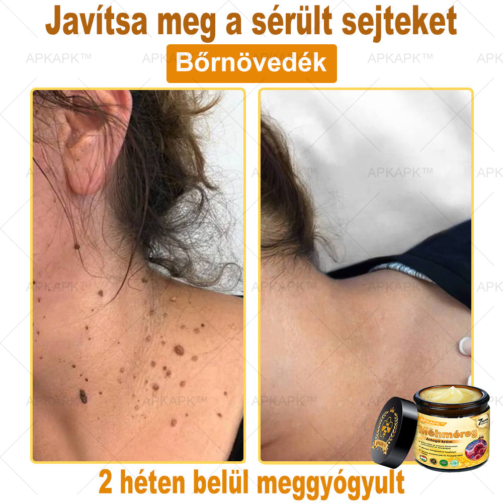 𝐀𝐏𝐊𝐀𝐏𝐊™ 𝐌É𝐇𝐌É𝐑𝐄𝐆 Á𝐓𝐅𝐎𝐆Ó 𝐊𝐑É𝐌🥇🥇𝐀 𝐛ö𝐫𝐩𝐫𝐨𝐛𝐥é𝐦á𝐤 𝐤𝐞𝐳𝐞𝐥é𝐬𝐞 𝐦𝐚𝐠á𝐛𝐚𝐧 𝐟𝐨𝐠𝐥𝐚𝐥𝐣𝐚: é𝐥𝐞𝐭𝐤𝐨𝐫𝐢 𝐟𝐨𝐥𝐭𝐨𝐤, 𝐡𝐞𝐠𝐞𝐤, 𝐬𝐳𝐞𝐦ö𝐥𝐜𝐬ö𝐤, 𝐛ö𝐫𝐧ö𝐯𝐞𝐝é𝐤𝐞𝐤, 𝐭á𝐥𝐲𝐨𝐠𝐨𝐤, 𝐩𝐚𝐭𝐭𝐚𝐧á𝐬𝐨𝐤, 𝐞𝐤𝐜é𝐦𝐚, 𝐩𝐬𝐨𝐫𝐢𝐚𝐬𝐢𝐬, 𝐚𝐜𝐧𝐞 𝐢𝐧𝐯𝐞𝐫𝐬𝐚, 𝐫á𝐧𝐜𝐨𝐤, 𝐛ö𝐫ö𝐫𝐞𝐠𝐞𝐝é𝐬 é𝐬 𝐞𝐠𝐲é𝐛 𝐩𝐫𝐨𝐛𝐥é𝐦á𝐤🔥