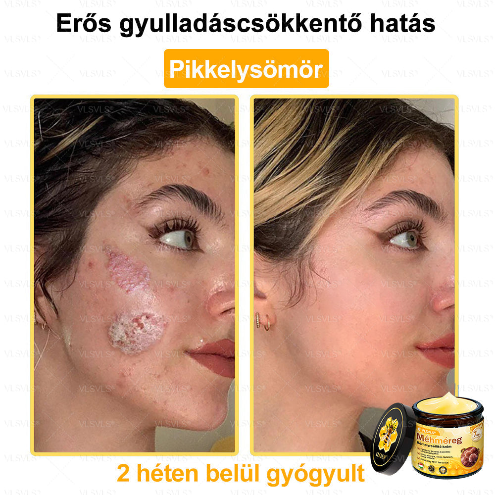 VLSVLS® Méhméreg Bőrhelyreállító Krém (👨⚕CE jóváhagyott)👍✅
