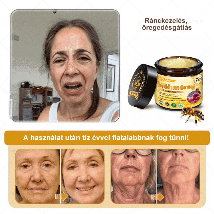𝐀𝐏𝐊𝐀𝐏𝐊™ 𝐌É𝐇𝐌É𝐑𝐄𝐆 Á𝐓𝐅𝐎𝐆Ó 𝐊𝐑É𝐌🥇🥇𝐀 𝐛ö𝐫𝐩𝐫𝐨𝐛𝐥é𝐦á𝐤 𝐤𝐞𝐳𝐞𝐥é𝐬𝐞 𝐦𝐚𝐠á𝐛𝐚𝐧 𝐟𝐨𝐠𝐥𝐚𝐥𝐣𝐚: é𝐥𝐞𝐭𝐤𝐨𝐫𝐢 𝐟𝐨𝐥𝐭𝐨𝐤, 𝐡𝐞𝐠𝐞𝐤, 𝐬𝐳𝐞𝐦ö𝐥𝐜𝐬ö𝐤, 𝐛ö𝐫𝐧ö𝐯𝐞𝐝é𝐤𝐞𝐤, 𝐭á𝐥𝐲𝐨𝐠𝐨𝐤, 𝐩𝐚𝐭𝐭𝐚𝐧á𝐬𝐨𝐤, 𝐞𝐤𝐜é𝐦𝐚, 𝐩𝐬𝐨𝐫𝐢𝐚𝐬𝐢𝐬, 𝐚𝐜𝐧𝐞 𝐢𝐧𝐯𝐞𝐫𝐬𝐚, 𝐫á𝐧𝐜𝐨𝐤, 𝐛ö𝐫ö𝐫𝐞𝐠𝐞𝐝é𝐬 é𝐬 𝐞𝐠𝐲é𝐛 𝐩𝐫𝐨𝐛𝐥é𝐦á𝐤🔥