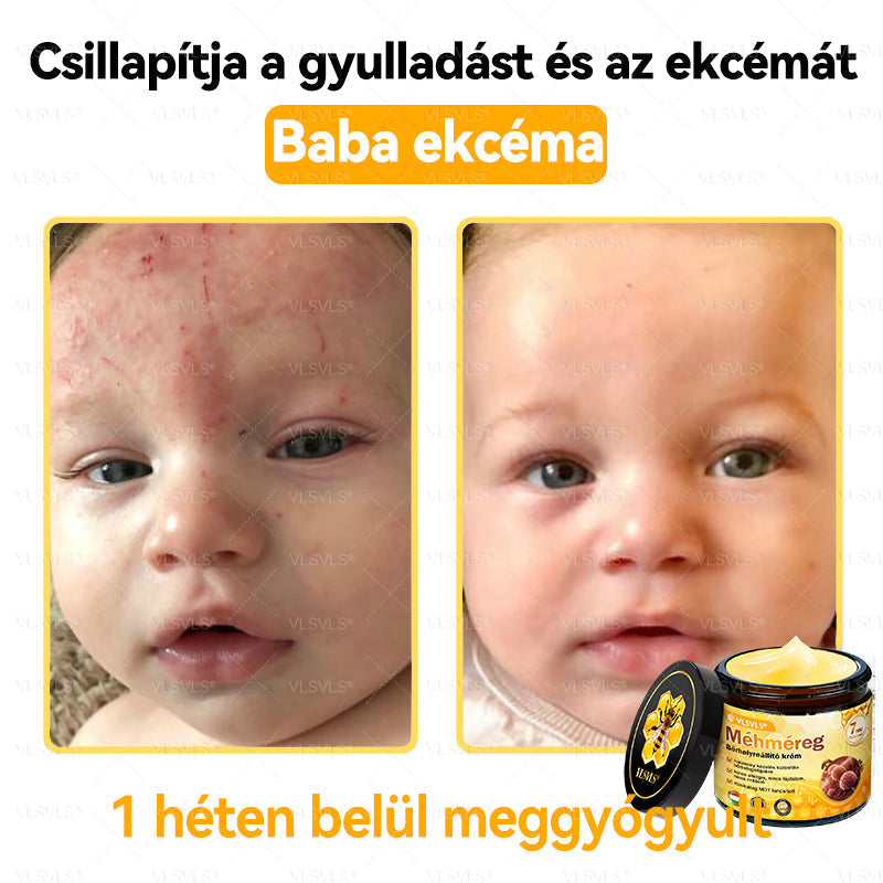 VLSVLS® Méhméreg Bőrhelyreállító Krém (👨⚕CE jóváhagyott)👍✅