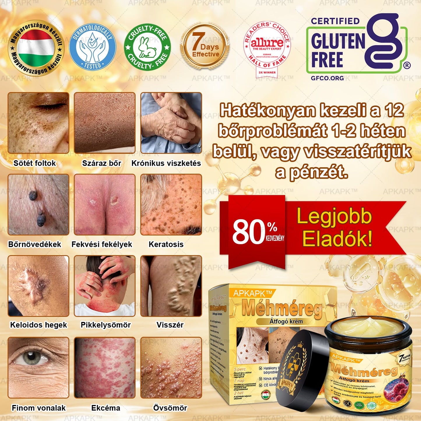 𝐀𝐏𝐊𝐀𝐏𝐊™ 𝐌É𝐇𝐌É𝐑𝐄𝐆 Á𝐓𝐅𝐎𝐆Ó 𝐊𝐑É𝐌🥇🥇𝐀 𝐛ö𝐫𝐩𝐫𝐨𝐛𝐥é𝐦á𝐤 𝐤𝐞𝐳𝐞𝐥é𝐬𝐞 𝐦𝐚𝐠á𝐛𝐚𝐧 𝐟𝐨𝐠𝐥𝐚𝐥𝐣𝐚: é𝐥𝐞𝐭𝐤𝐨𝐫𝐢 𝐟𝐨𝐥𝐭𝐨𝐤, 𝐡𝐞𝐠𝐞𝐤, 𝐬𝐳𝐞𝐦ö𝐥𝐜𝐬ö𝐤, 𝐛ö𝐫𝐧ö𝐯𝐞𝐝é𝐤𝐞𝐤, 𝐭á𝐥𝐲𝐨𝐠𝐨𝐤, 𝐩𝐚𝐭𝐭𝐚𝐧á𝐬𝐨𝐤, 𝐞𝐤𝐜é𝐦𝐚, 𝐩𝐬𝐨𝐫𝐢𝐚𝐬𝐢𝐬, 𝐚𝐜𝐧𝐞 𝐢𝐧𝐯𝐞𝐫𝐬𝐚, 𝐫á𝐧𝐜𝐨𝐤, 𝐛ö𝐫ö𝐫𝐞𝐠𝐞𝐝é𝐬 é𝐬 𝐞𝐠𝐲é𝐛 𝐩𝐫𝐨𝐛𝐥é𝐦á𝐤🔥