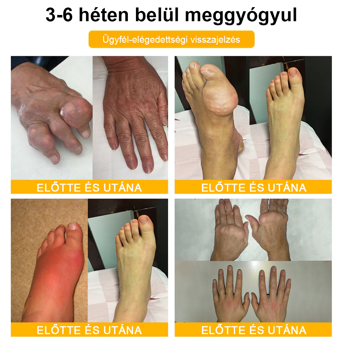 🦴TLOPA® Botulinum Toxin és Méhméreg Fájdalomcsillapító Csontgyógyító Krém🐝 🔥(Kifejezetten időseknek & ortopéd szakorvosok ajánlásával)🦴🦴🦴🦴🦴