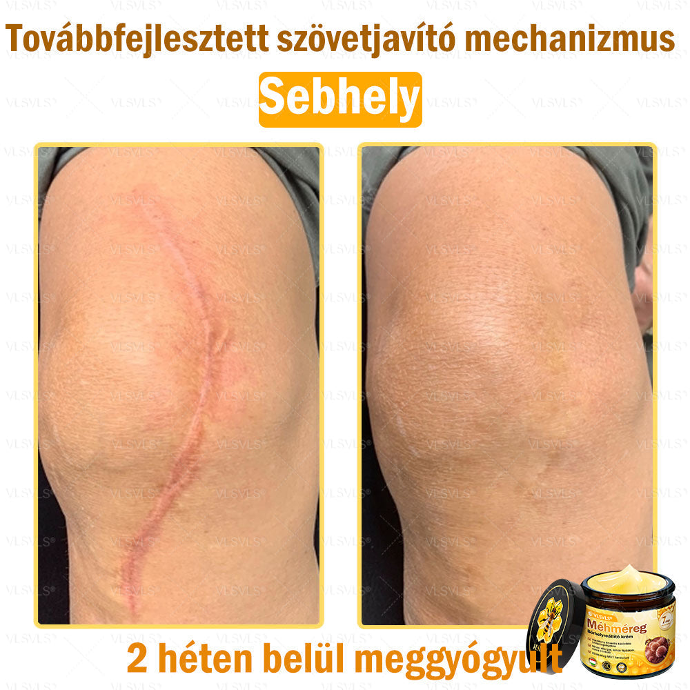 VLSVLS® Méhméreg Bőrhelyreállító Krém (👨⚕CE jóváhagyott)👍✅