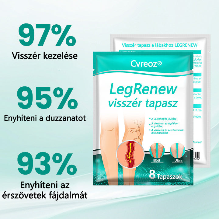 Cvreoz® LegRenew visszér tapasz javítja a vénák egészségét és megszünteti a visszereket🌿Nincs tű, nincs műtét, csak biztonságos, gyengéd és hatékony eredmény✨