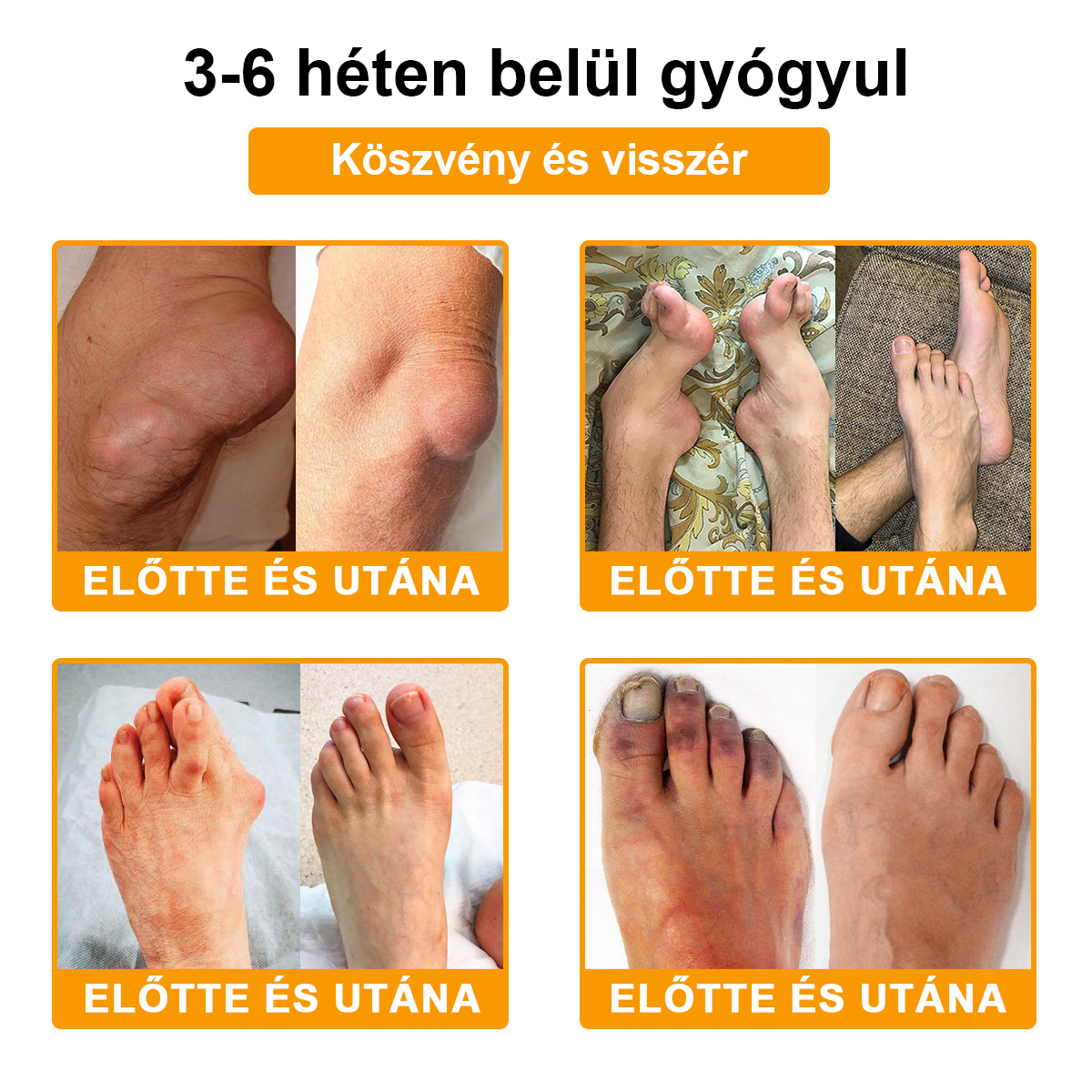 🦴TLOPA® Botulinum Toxin és Méhméreg Fájdalomcsillapító Csontgyógyító Krém🐝 🔥(Kifejezetten időseknek & ortopéd szakorvosok ajánlásával)🦴🦴🦴🦴🦴