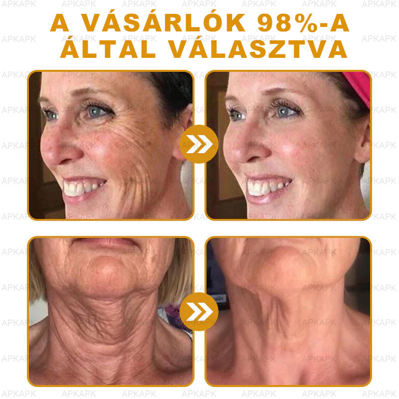 𝐀𝐏𝐊𝐀𝐏𝐊™ 𝐌É𝐇𝐌É𝐑𝐄𝐆 Á𝐓𝐅𝐎𝐆Ó 𝐊𝐑É𝐌🥇🥇𝐀 𝐛ö𝐫𝐩𝐫𝐨𝐛𝐥é𝐦á𝐤 𝐤𝐞𝐳𝐞𝐥é𝐬𝐞 𝐦𝐚𝐠á𝐛𝐚𝐧 𝐟𝐨𝐠𝐥𝐚𝐥𝐣𝐚: é𝐥𝐞𝐭𝐤𝐨𝐫𝐢 𝐟𝐨𝐥𝐭𝐨𝐤, 𝐡𝐞𝐠𝐞𝐤, 𝐬𝐳𝐞𝐦ö𝐥𝐜𝐬ö𝐤, 𝐛ö𝐫𝐧ö𝐯𝐞𝐝é𝐤𝐞𝐤, 𝐭á𝐥𝐲𝐨𝐠𝐨𝐤, 𝐩𝐚𝐭𝐭𝐚𝐧á𝐬𝐨𝐤, 𝐞𝐤𝐜é𝐦𝐚, 𝐩𝐬𝐨𝐫𝐢𝐚𝐬𝐢𝐬, 𝐚𝐜𝐧𝐞 𝐢𝐧𝐯𝐞𝐫𝐬𝐚, 𝐫á𝐧𝐜𝐨𝐤, 𝐛ö𝐫ö𝐫𝐞𝐠𝐞𝐝é𝐬 é𝐬 𝐞𝐠𝐲é𝐛 𝐩𝐫𝐨𝐛𝐥é𝐦á𝐤🔥