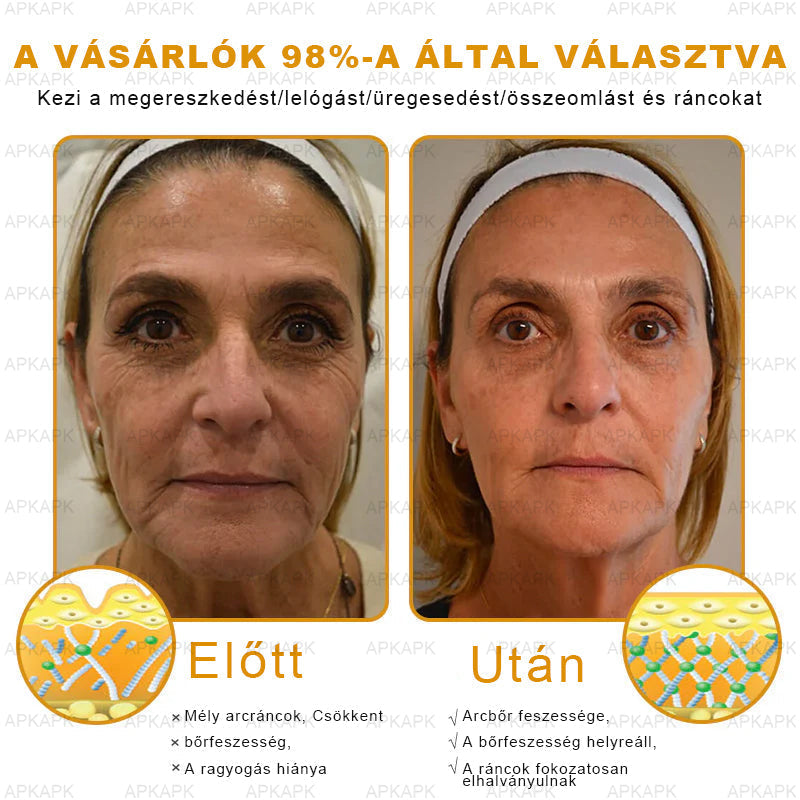 𝐀𝐏𝐊𝐀𝐏𝐊™ 𝐌É𝐇𝐌É𝐑𝐄𝐆 Á𝐓𝐅𝐎𝐆Ó 𝐊𝐑É𝐌🥇🥇𝐀 𝐛ö𝐫𝐩𝐫𝐨𝐛𝐥é𝐦á𝐤 𝐤𝐞𝐳𝐞𝐥é𝐬𝐞 𝐦𝐚𝐠á𝐛𝐚𝐧 𝐟𝐨𝐠𝐥𝐚𝐥𝐣𝐚: é𝐥𝐞𝐭𝐤𝐨𝐫𝐢 𝐟𝐨𝐥𝐭𝐨𝐤, 𝐡𝐞𝐠𝐞𝐤, 𝐬𝐳𝐞𝐦ö𝐥𝐜𝐬ö𝐤, 𝐛ö𝐫𝐧ö𝐯𝐞𝐝é𝐤𝐞𝐤, 𝐭á𝐥𝐲𝐨𝐠𝐨𝐤, 𝐩𝐚𝐭𝐭𝐚𝐧á𝐬𝐨𝐤, 𝐞𝐤𝐜é𝐦𝐚, 𝐩𝐬𝐨𝐫𝐢𝐚𝐬𝐢𝐬, 𝐚𝐜𝐧𝐞 𝐢𝐧𝐯𝐞𝐫𝐬𝐚, 𝐫á𝐧𝐜𝐨𝐤, 𝐛ö𝐫ö𝐫𝐞𝐠𝐞𝐝é𝐬 é𝐬 𝐞𝐠𝐲é𝐛 𝐩𝐫𝐨𝐛𝐥é𝐦á𝐤🔥