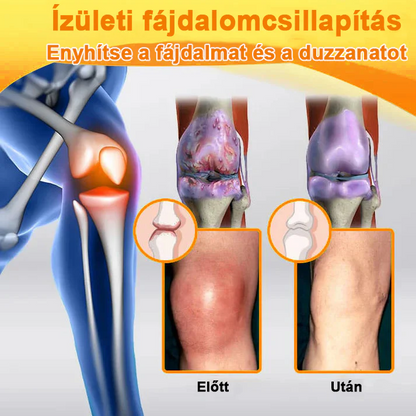 ✅ Hivatalos áruház: Ouryard™ Magnéziumolaj és Mézes Ízületjavító Spray 👨‍⚕️ Jóváhagyva a Magyar Gyógyszerészeti és Egészségügyi Minőség- és Szervezetfejlesztési Intézet (OGYÉI) által. 🔥🔥🔥