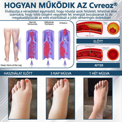 Cvreoz® Fekete kömény Ödéma méregtelenítő gyógynövénykrém - a gyors, látható enyhülés érdekében🍃🍃🍃