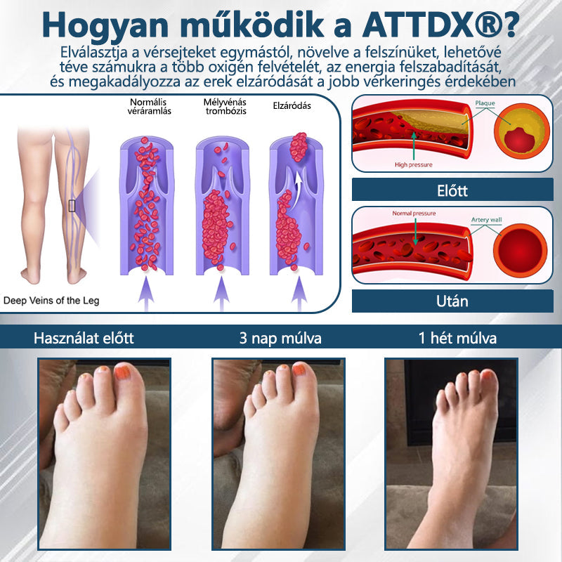 💧ATTDX® Növényi ödéma enyhítő krém nigellával💧💧