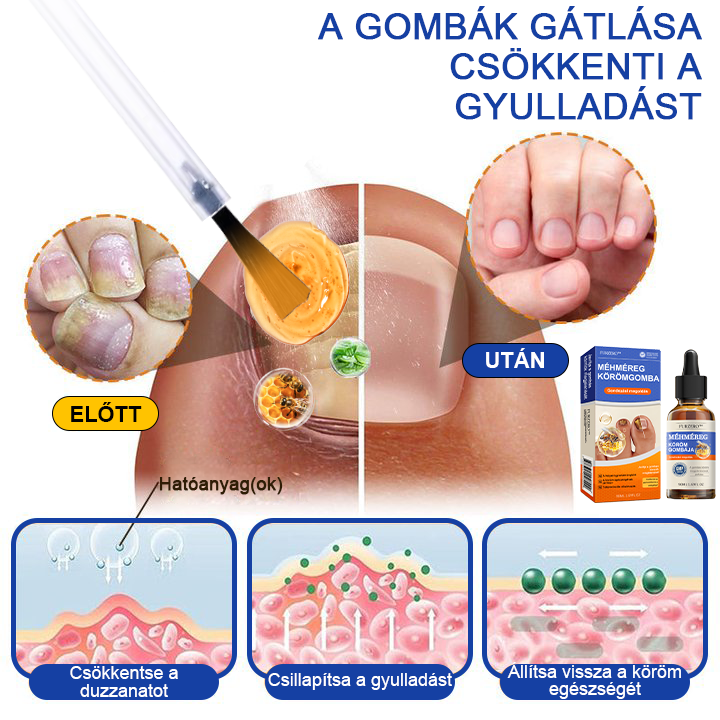 👣🐝🐝Furzero™ Méhméreg Körömgomba Kezelőoldat: Teljes megoldás a körömgomba problémájára🌟👣🐝👣