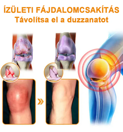 ✅ Hivatalos áruház: Ouryard™ Magnéziumolaj és Mézes Ízületjavító Spray 👨‍⚕️ Jóváhagyva a Magyar Gyógyszerészeti és Egészségügyi Minőség- és Szervezetfejlesztési Intézet (OGYÉI) által. 🔥🔥🔥
