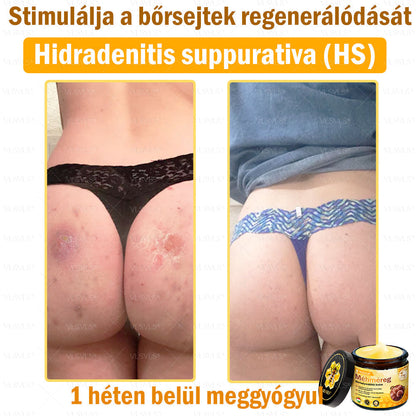 VLSVLS® Méhméreg Bőrhelyreállító Krém (👨‍⚕‍CE jóváhagyott)👍✅✅✅✅✅