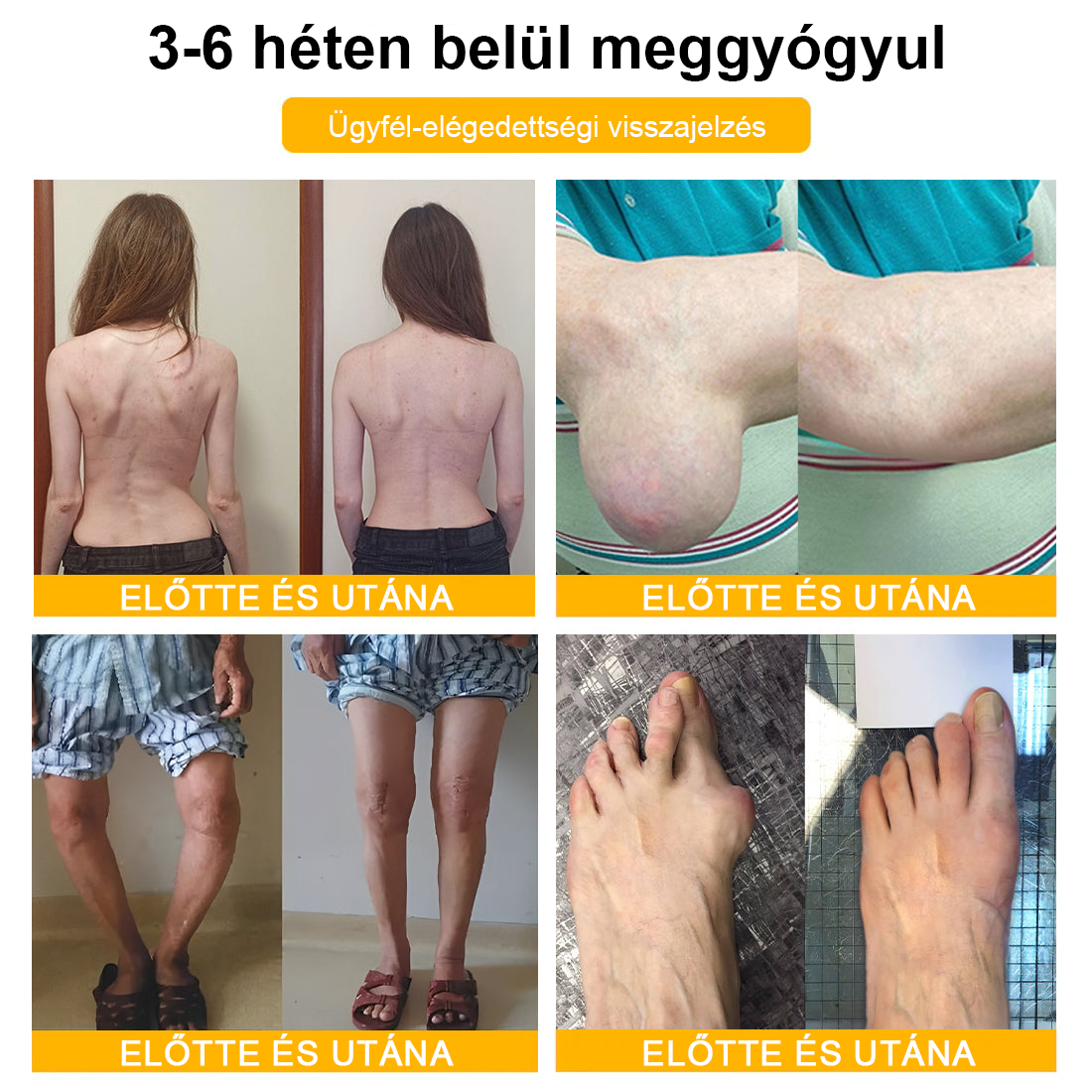 🦴TLOPA® Botulinum Toxin és Méhméreg Fájdalomcsillapító Csontgyógyító Krém🐝 🔥(Kifejezetten időseknek & ortopéd szakorvosok ajánlásával)🦴🦴🦴🦴🦴