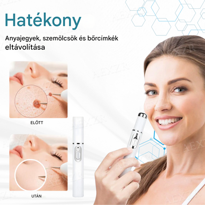 🔥Bikenda® non-invazív anyajegy- és szemölcseltávolító lézertoll🔥🔥🔥🔥
