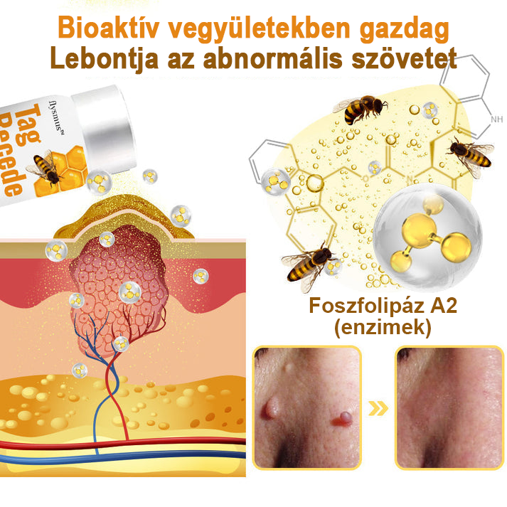 [💗utánvétel (COD)💗] Flysmus™Méhméreg szemölcs és övsömör eltávolító spray (👨‍⚕AAD Ajánlott) 🐝🐝(🔥Last Day 80% Off)🔥