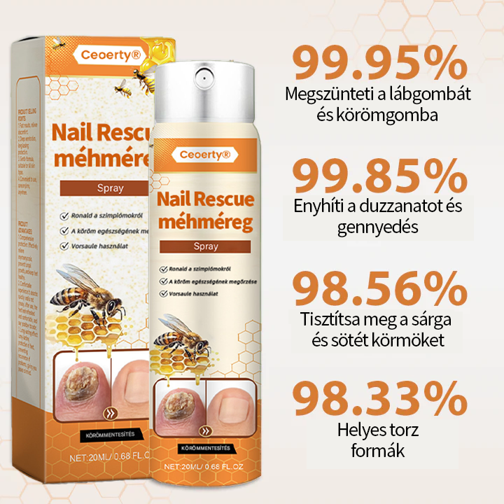 💥 2025 Korlátozott 70% KEDVEZMÉNY ️⏳ Ceoerty® NailRescue Kolirin méhméreg körömgomba spray 💥 Minden körömproblémát orvosolhatsz 2 héten belül👣👣👣