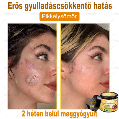 𝐀𝐏𝐊𝐀𝐏𝐊™ 𝐌É𝐇𝐌É𝐑𝐄𝐆 Á𝐓𝐅𝐎𝐆Ó 𝐊𝐑É𝐌🥇🥇𝐀 𝐛ö𝐫𝐩𝐫𝐨𝐛𝐥é𝐦á𝐤 𝐤𝐞𝐳𝐞𝐥é𝐬𝐞 𝐦𝐚𝐠á𝐛𝐚𝐧 𝐟𝐨𝐠𝐥𝐚𝐥𝐣𝐚: é𝐥𝐞𝐭𝐤𝐨𝐫𝐢 𝐟𝐨𝐥𝐭𝐨𝐤, 𝐡𝐞𝐠𝐞𝐤, 𝐬𝐳𝐞𝐦ö𝐥𝐜𝐬ö𝐤, 𝐛ö𝐫𝐧ö𝐯𝐞𝐝é𝐤𝐞𝐤, 𝐭á𝐥𝐲𝐨𝐠𝐨𝐤, 𝐩𝐚𝐭𝐭𝐚𝐧á𝐬𝐨𝐤, 𝐞𝐤𝐜é𝐦𝐚, 𝐩𝐬𝐨𝐫𝐢𝐚𝐬𝐢𝐬, 𝐚𝐜𝐧𝐞 𝐢𝐧𝐯𝐞𝐫𝐬𝐚, 𝐫á𝐧𝐜𝐨𝐤, 𝐛ö𝐫ö𝐫𝐞𝐠𝐞𝐝é𝐬 é𝐬 𝐞𝐠𝐲é𝐛 𝐩𝐫𝐨𝐛𝐥é𝐦á𝐤🔥🔥🔥