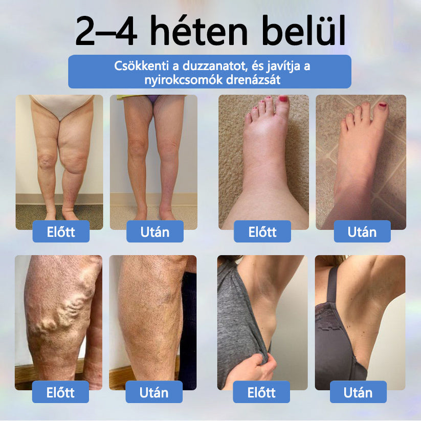 💧ATTDX® Növényi ödéma enyhítő krém nigellával💧💧
