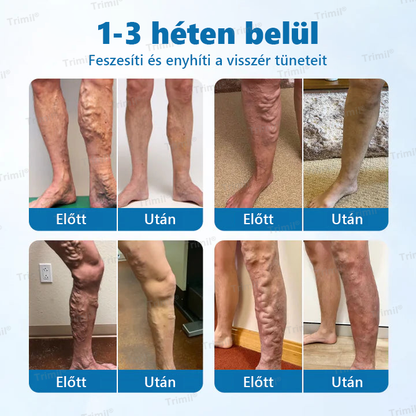 💚💚Trimil® VeinGuard Gyógynövényes Spray - ✅ Klinikailag bizonyított, hogy mindössze 7 nap alatt megszünteti a visszereket!💚💚💚