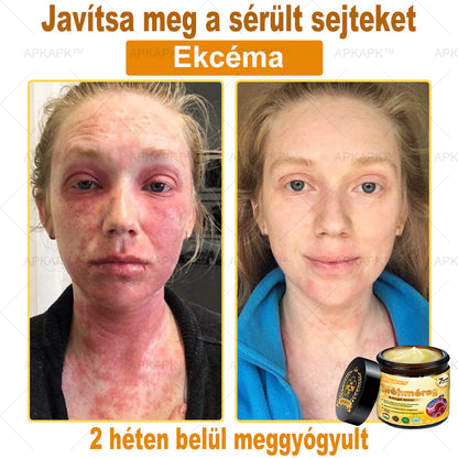 𝐀𝐏𝐊𝐀𝐏𝐊™ 𝐌É𝐇𝐌É𝐑𝐄𝐆 Á𝐓𝐅𝐎𝐆Ó 𝐊𝐑É𝐌🥇🥇𝐀 𝐛ö𝐫𝐩𝐫𝐨𝐛𝐥é𝐦á𝐤 𝐤𝐞𝐳𝐞𝐥é𝐬𝐞 𝐦𝐚𝐠á𝐛𝐚𝐧 𝐟𝐨𝐠𝐥𝐚𝐥𝐣𝐚: é𝐥𝐞𝐭𝐤𝐨𝐫𝐢 𝐟𝐨𝐥𝐭𝐨𝐤, 𝐡𝐞𝐠𝐞𝐤, 𝐬𝐳𝐞𝐦ö𝐥𝐜𝐬ö𝐤, 𝐛ö𝐫𝐧ö𝐯𝐞𝐝é𝐤𝐞𝐤, 𝐭á𝐥𝐲𝐨𝐠𝐨𝐤, 𝐩𝐚𝐭𝐭𝐚𝐧á𝐬𝐨𝐤, 𝐞𝐤𝐜é𝐦𝐚, 𝐩𝐬𝐨𝐫𝐢𝐚𝐬𝐢𝐬, 𝐚𝐜𝐧𝐞 𝐢𝐧𝐯𝐞𝐫𝐬𝐚, 𝐫á𝐧𝐜𝐨𝐤, 𝐛ö𝐫ö𝐫𝐞𝐠𝐞𝐝é𝐬 é𝐬 𝐞𝐠𝐲é𝐛 𝐩𝐫𝐨𝐛𝐥é𝐦á𝐤🔥🔥🔥