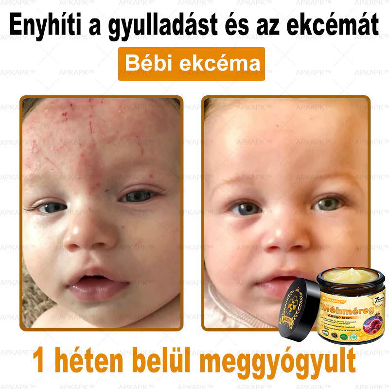 𝐀𝐏𝐊𝐀𝐏𝐊™ 𝐌É𝐇𝐌É𝐑𝐄𝐆 Á𝐓𝐅𝐎𝐆Ó 𝐊𝐑É𝐌🥇🥇𝐀 𝐛ö𝐫𝐩𝐫𝐨𝐛𝐥é𝐦á𝐤 𝐤𝐞𝐳𝐞𝐥é𝐬𝐞 𝐦𝐚𝐠á𝐛𝐚𝐧 𝐟𝐨𝐠𝐥𝐚𝐥𝐣𝐚: é𝐥𝐞𝐭𝐤𝐨𝐫𝐢 𝐟𝐨𝐥𝐭𝐨𝐤, 𝐡𝐞𝐠𝐞𝐤, 𝐬𝐳𝐞𝐦ö𝐥𝐜𝐬ö𝐤, 𝐛ö𝐫𝐧ö𝐯𝐞𝐝é𝐤𝐞𝐤, 𝐭á𝐥𝐲𝐨𝐠𝐨𝐤, 𝐩𝐚𝐭𝐭𝐚𝐧á𝐬𝐨𝐤, 𝐞𝐤𝐜é𝐦𝐚, 𝐩𝐬𝐨𝐫𝐢𝐚𝐬𝐢𝐬, 𝐚𝐜𝐧𝐞 𝐢𝐧𝐯𝐞𝐫𝐬𝐚, 𝐫á𝐧𝐜𝐨𝐤, 𝐛ö𝐫ö𝐫𝐞𝐠𝐞𝐝é𝐬 é𝐬 𝐞𝐠𝐲é𝐛 𝐩𝐫𝐨𝐛𝐥é𝐦á𝐤🔥🔥🔥