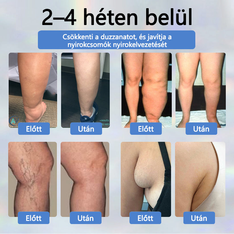 💧ATTDX® Növényi ödéma enyhítő krém nigellával💧💧