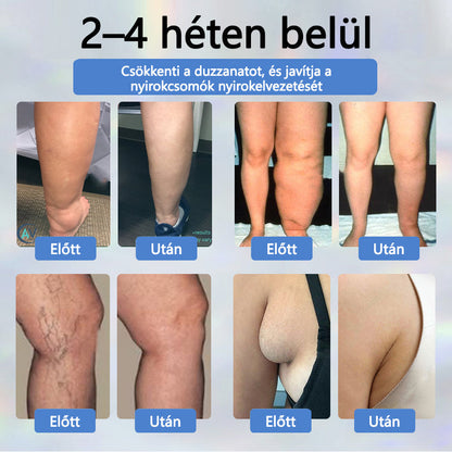 💧ATTDX® Növényi ödéma enyhítő krém nigellával💧💧