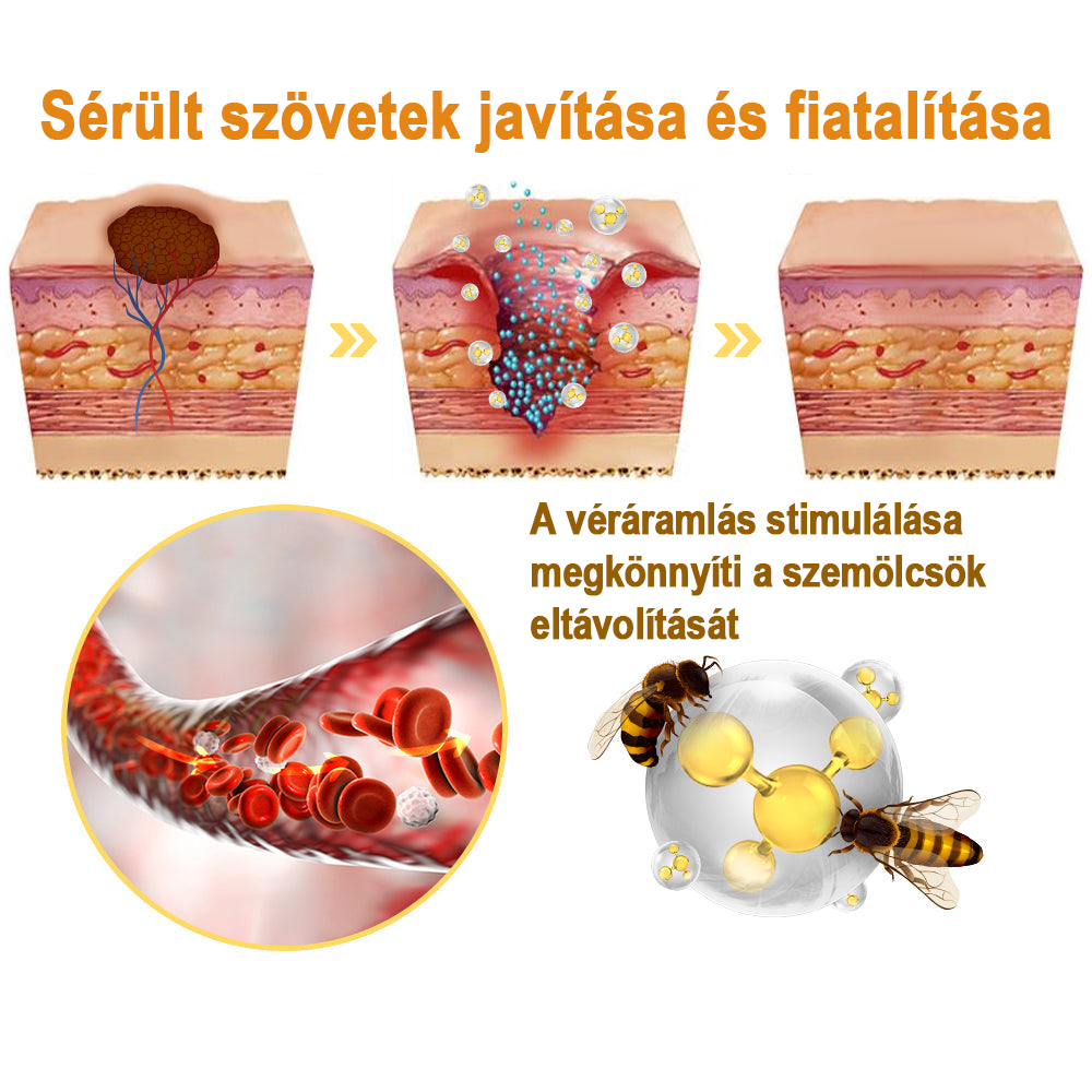 [💗utánvétel (COD)💗] Flysmus™Méhméreg szemölcs és övsömör eltávolító spray (👨‍⚕AAD Ajánlott) 🐝🐝(🔥Last Day 80% Off)🔥
