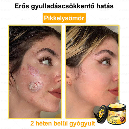 VLSVLS® Méhméreg Bőrhelyreállító Krém (👨‍⚕‍CE jóváhagyott)👍✅✅✅✅✅