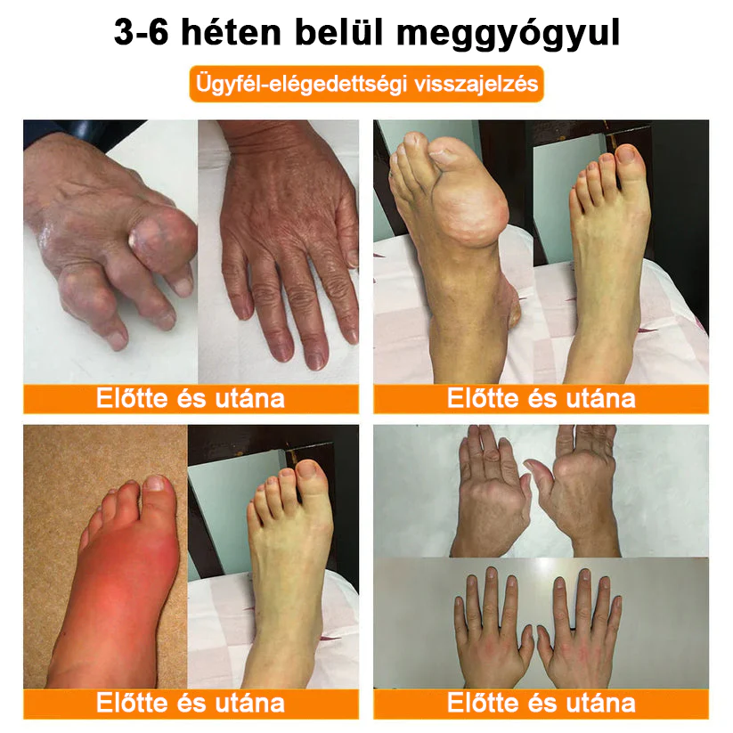 ✅ Hivatalos áruház: Ouryard™ Magnéziumolaj és Mézes Ízületjavító Spray 👨‍⚕️ Jóváhagyva a Magyar Gyógyszerészeti és Egészségügyi Minőség- és Szervezetfejlesztési Intézet (OGYÉI) által. 🔥🔥🔥