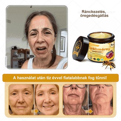 𝐀𝐏𝐊𝐀𝐏𝐊™ 𝐌É𝐇𝐌É𝐑𝐄𝐆 Á𝐓𝐅𝐎𝐆Ó 𝐊𝐑É𝐌🥇🥇𝐀 𝐛ö𝐫𝐩𝐫𝐨𝐛𝐥é𝐦á𝐤 𝐤𝐞𝐳𝐞𝐥é𝐬𝐞 𝐦𝐚𝐠á𝐛𝐚𝐧 𝐟𝐨𝐠𝐥𝐚𝐥𝐣𝐚: é𝐥𝐞𝐭𝐤𝐨𝐫𝐢 𝐟𝐨𝐥𝐭𝐨𝐤, 𝐡𝐞𝐠𝐞𝐤, 𝐬𝐳𝐞𝐦ö𝐥𝐜𝐬ö𝐤, 𝐛ö𝐫𝐧ö𝐯𝐞𝐝é𝐤𝐞𝐤, 𝐭á𝐥𝐲𝐨𝐠𝐨𝐤, 𝐩𝐚𝐭𝐭𝐚𝐧á𝐬𝐨𝐤, 𝐞𝐤𝐜é𝐦𝐚, 𝐩𝐬𝐨𝐫𝐢𝐚𝐬𝐢𝐬, 𝐚𝐜𝐧𝐞 𝐢𝐧𝐯𝐞𝐫𝐬𝐚, 𝐫á𝐧𝐜𝐨𝐤, 𝐛ö𝐫ö𝐫𝐞𝐠𝐞𝐝é𝐬 é𝐬 𝐞𝐠𝐲é𝐛 𝐩𝐫𝐨𝐛𝐥é𝐦á𝐤🔥🔥🔥
