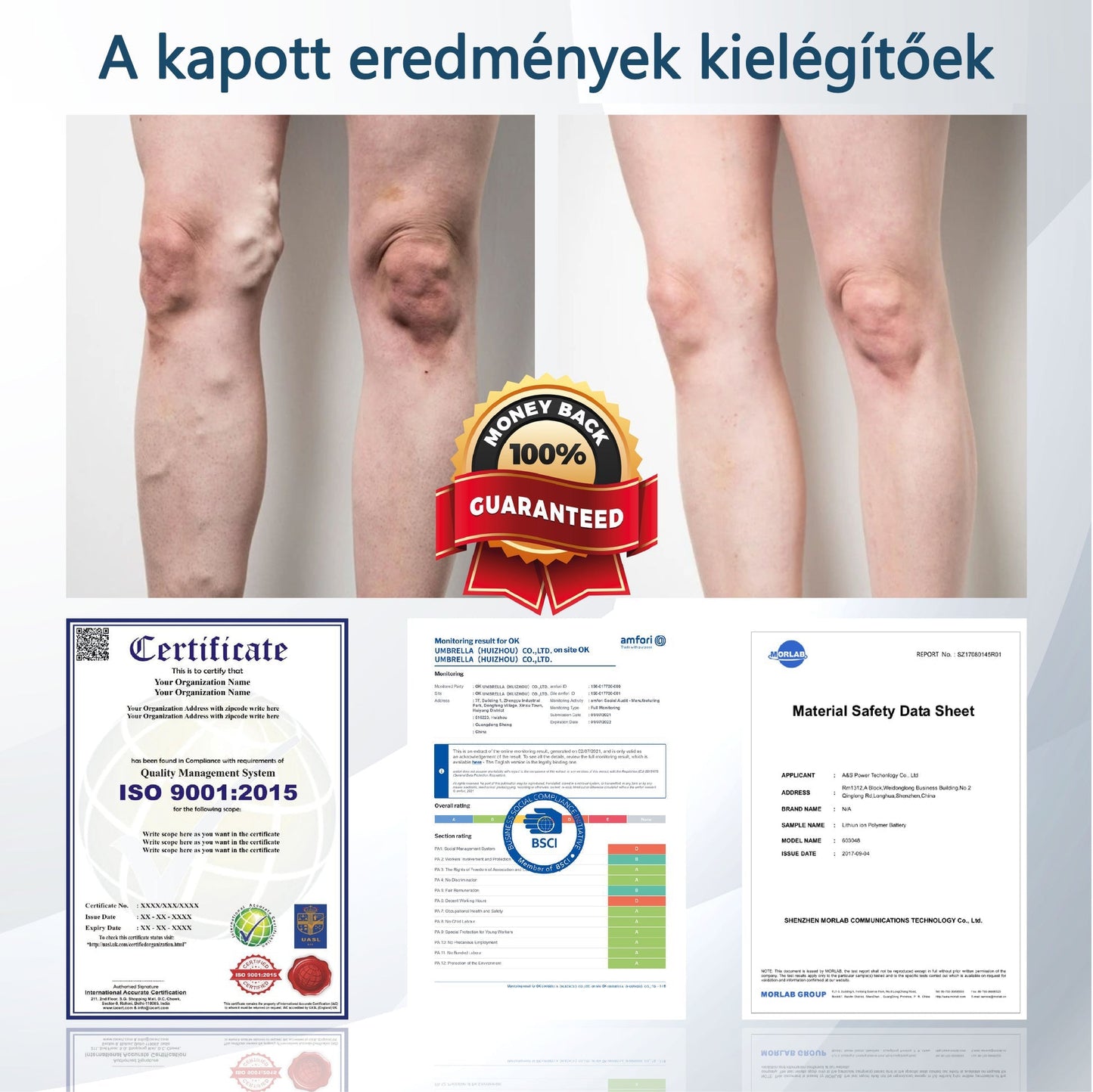 💧ATTDX® Növényi ödéma enyhítő krém nigellával💧💧