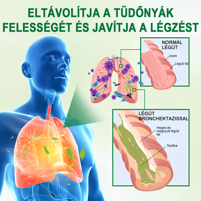 ☘️[Hivatalos márkaüzlet] 👨‍⚕️𝐌𝐈𝐐𝐈𝐊𝐎® Fejlett tüdőtisztító spray (☘️Tüdőspecialisták ajánlásával)☘️☘️