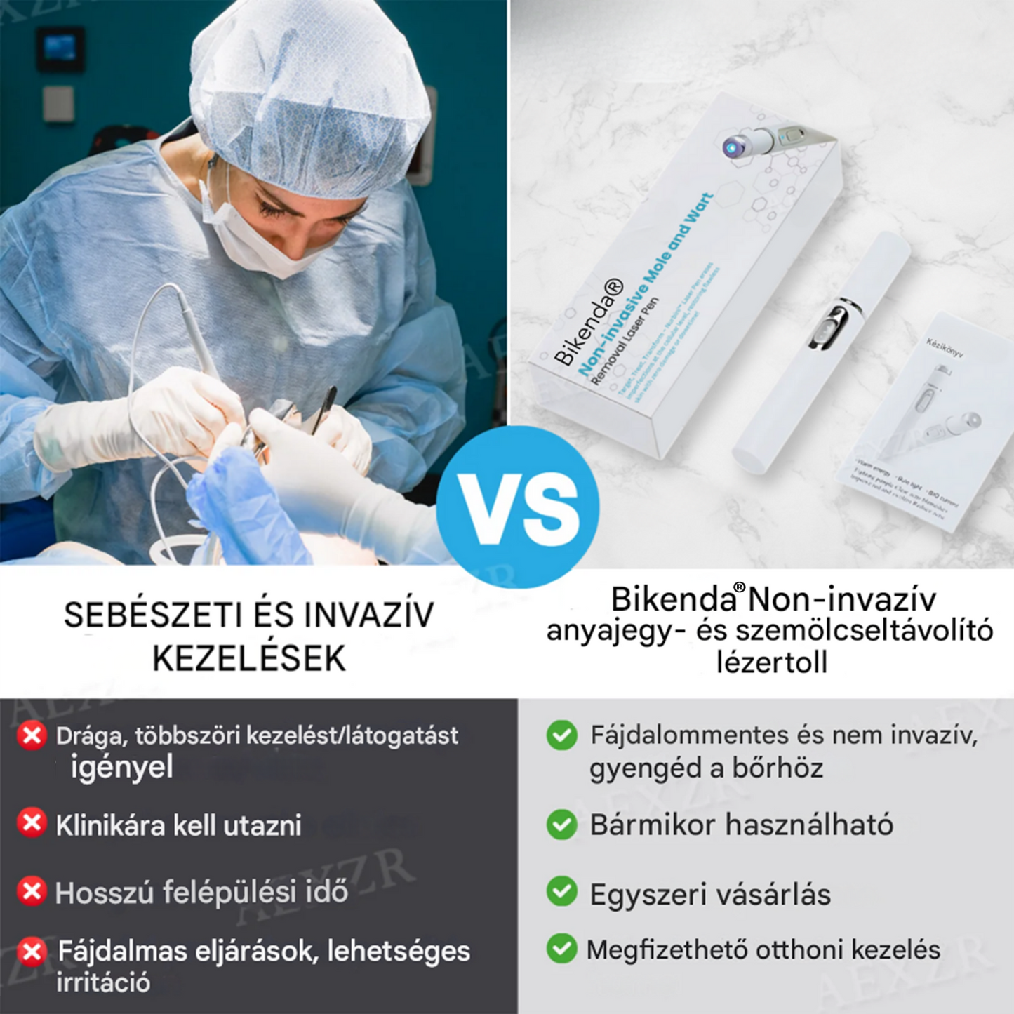 🔥Bikenda® non-invazív anyajegy- és szemölcseltávolító lézertoll🔥🔥🔥🔥