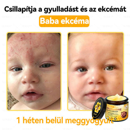VLSVLS® Méhméreg Bőrhelyreállító Krém (👨‍⚕‍CE jóváhagyott)👍✅✅✅✅✅