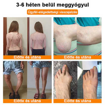 ✅ Hivatalos áruház: Ouryard™ Magnéziumolaj és Mézes Ízületjavító Spray 👨‍⚕️ Jóváhagyva a Magyar Gyógyszerészeti és Egészségügyi Minőség- és Szervezetfejlesztési Intézet (OGYÉI) által. 🔥🔥🔥