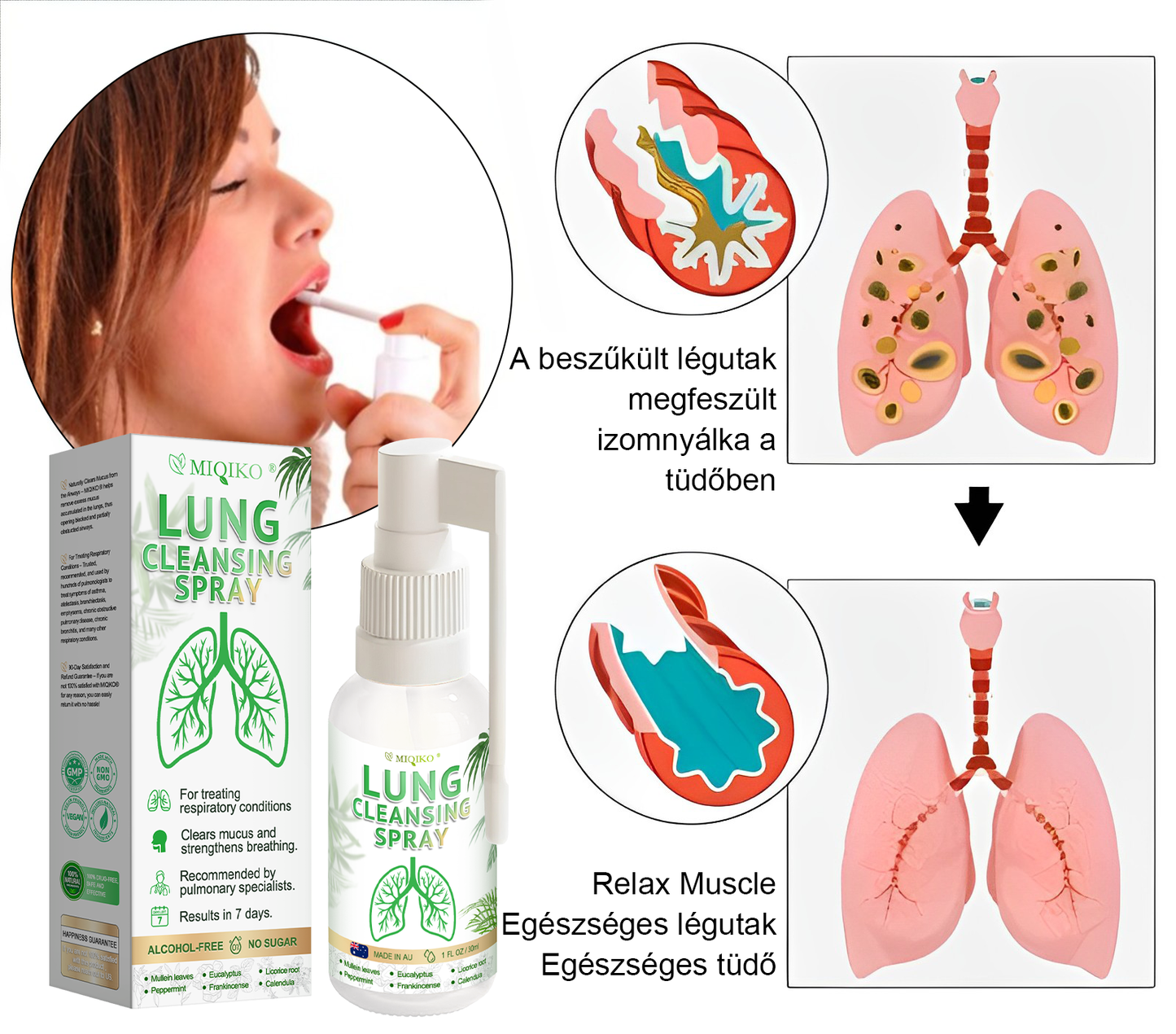 ☘️[Hivatalos márkaüzlet] 👨‍⚕️𝐌𝐈𝐐𝐈𝐊𝐎® Fejlett tüdőtisztító spray (☘️Tüdőspecialisták ajánlásával)☘️☘️
