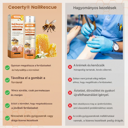 💥 2025 Korlátozott 70% KEDVEZMÉNY ️⏳ Ceoerty® NailRescue Kolirin méhméreg körömgomba spray 💥 Minden körömproblémát orvosolhatsz 2 héten belül👣👣👣