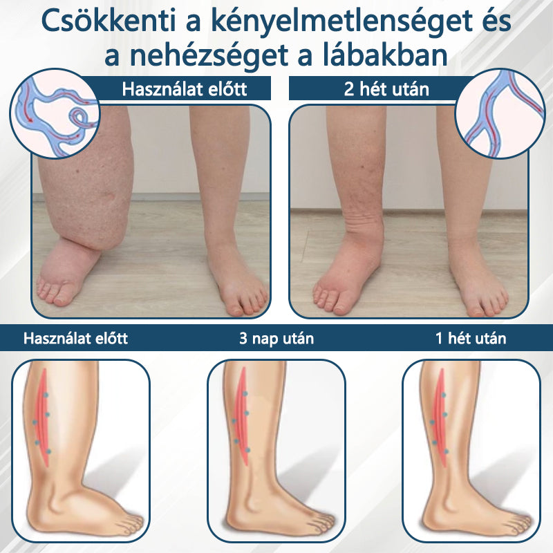 Cvreoz® Fekete kömény Ödéma méregtelenítő gyógynövénykrém - a gyors, látható enyhülés érdekében🍃🍃🍃