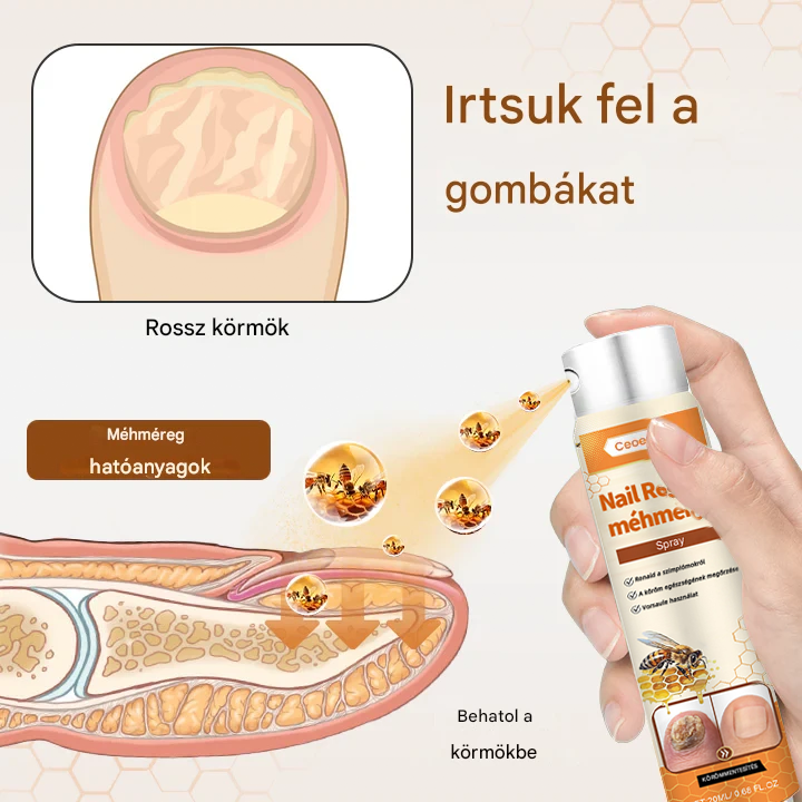 💥 2025 Korlátozott 70% KEDVEZMÉNY ️⏳ Ceoerty® NailRescue Kolirin méhméreg körömgomba spray 💥 Minden körömproblémát orvosolhatsz 2 héten belül👣👣👣