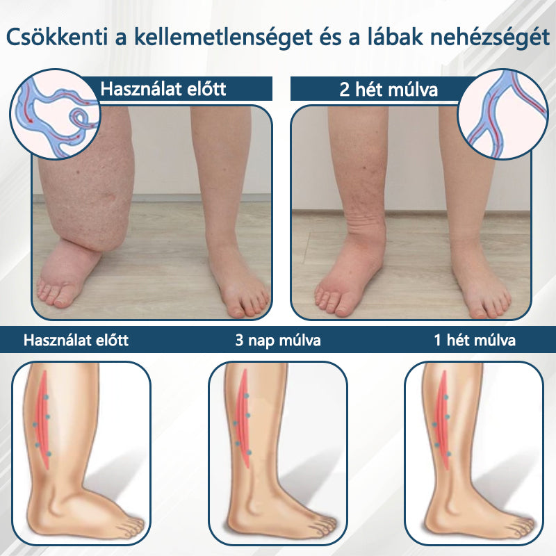 💧ATTDX® Növényi ödéma enyhítő krém nigellával💧💧