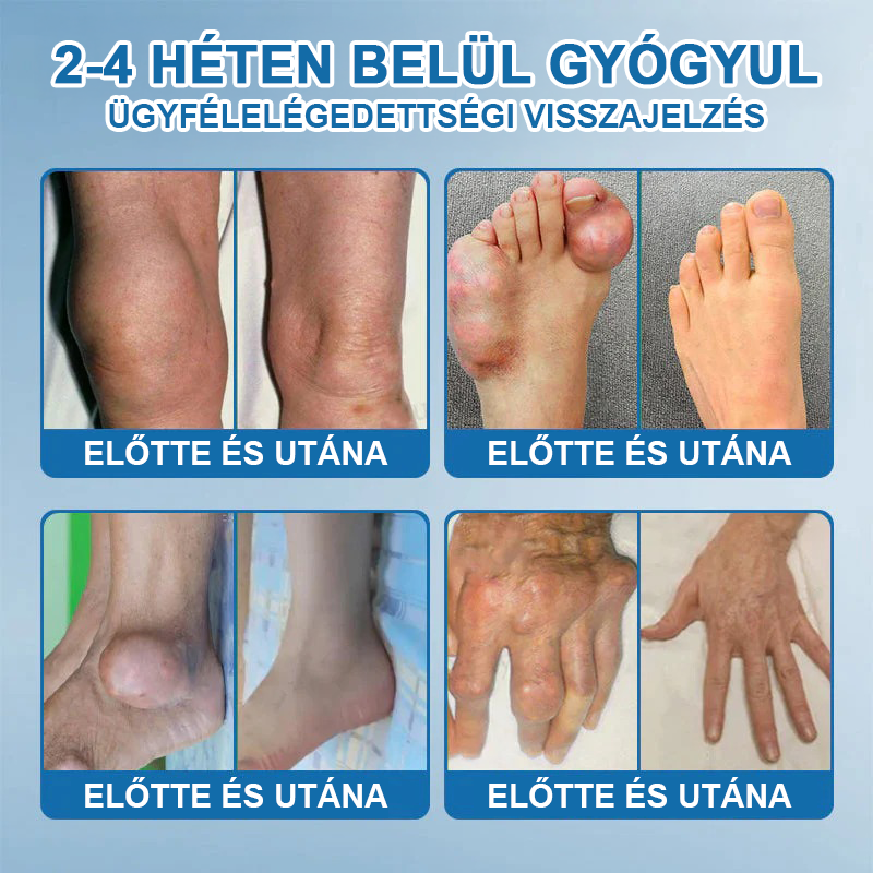 𝖯𝗂𝖼𝗱𝗼® BPC-157 Ízületi Gyógyító Krém🦴Ízületi gyulladás, neuropátia, reuma, sportsérülések és egyebek kezelésére🦵🦵🦵🦵