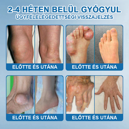 𝖯𝗂𝖼𝗱𝗼® BPC-157 Ízületi Gyógyító Krém🦴Ízületi gyulladás, neuropátia, reuma, sportsérülések és egyebek kezelésére🦵🦵🦵🦵