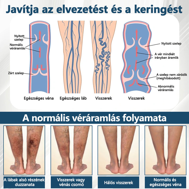💧ATTDX® Növényi ödéma enyhítő krém nigellával💧💧